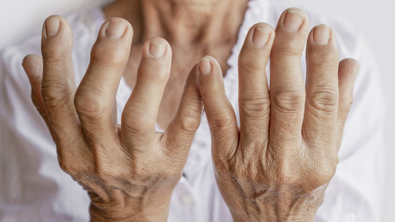 Testimonio Artritis
